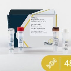 VIRSeek Food Hepatitis E Virus Real-time RT-PCR